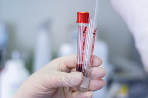 От котов до слонов: ученые нашли универсальный биомаркер старения